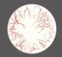 【ブラインド】キングダム・血管